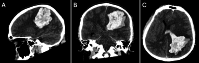 FIG. 1.