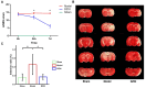 Graph A shows motor neurological severity score (mNSS) over time for sham, model, and DZXI groups. Images B depict brain sections for each group after various treatments. Graph C shows the infarction ratio percentage for the same groups, indicating significant differences marked by asterisks.