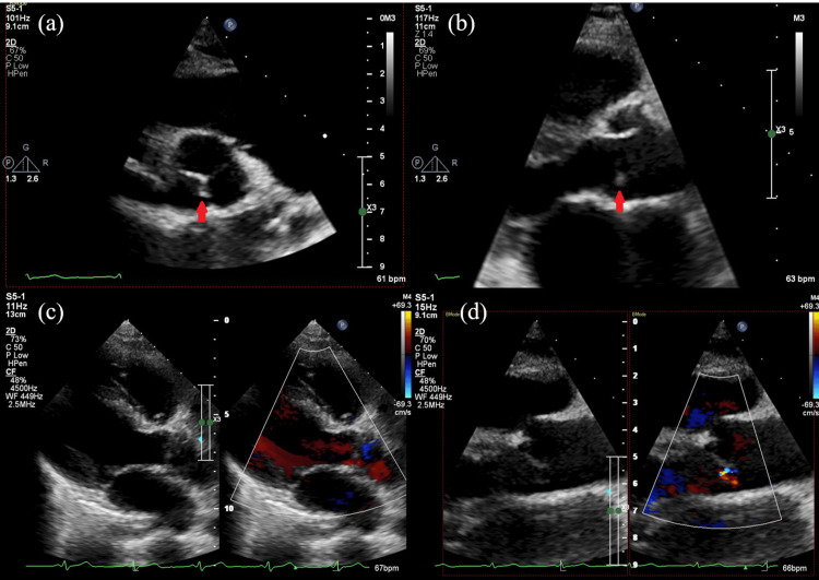 Figure 2