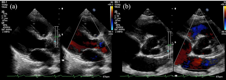 Figure 4