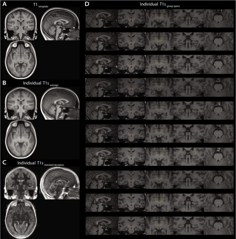 Figure 2—figure supplement 2.