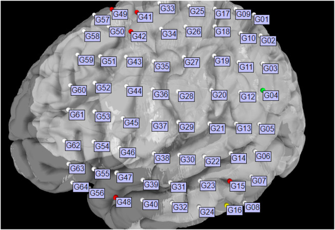 FIGURE 6