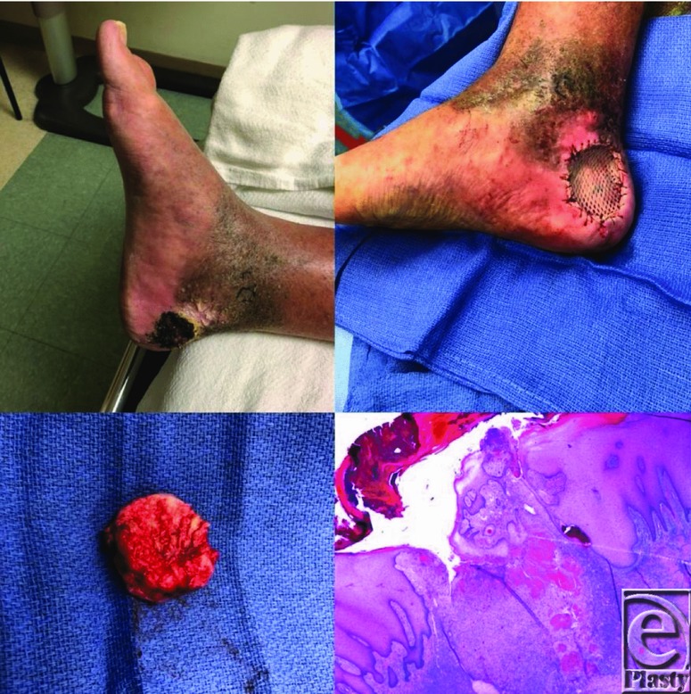 graphic file with name eplasty19ic01_fig1.jpg