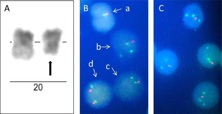 Fig 1