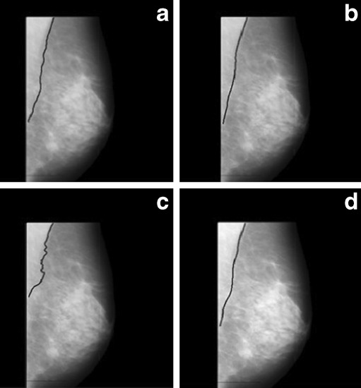 Fig. 10