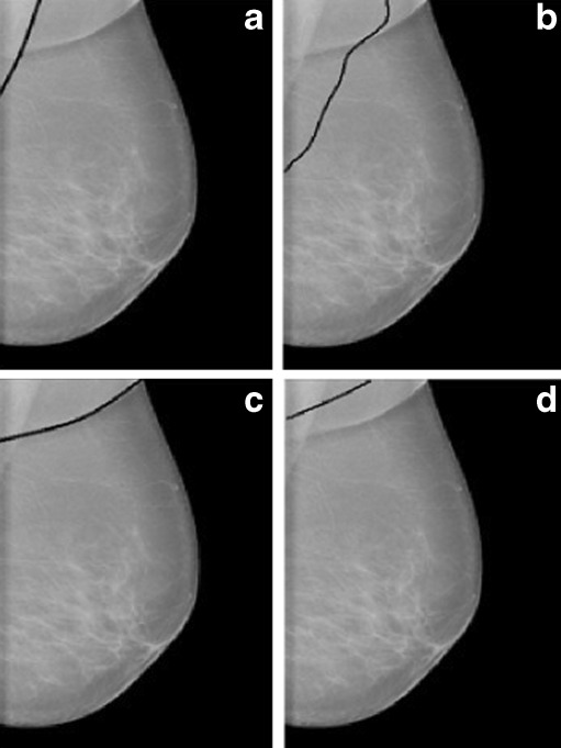 Fig. 14