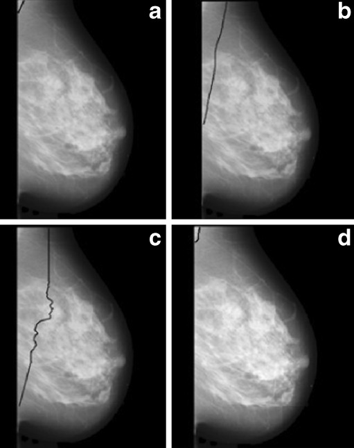 Fig. 13