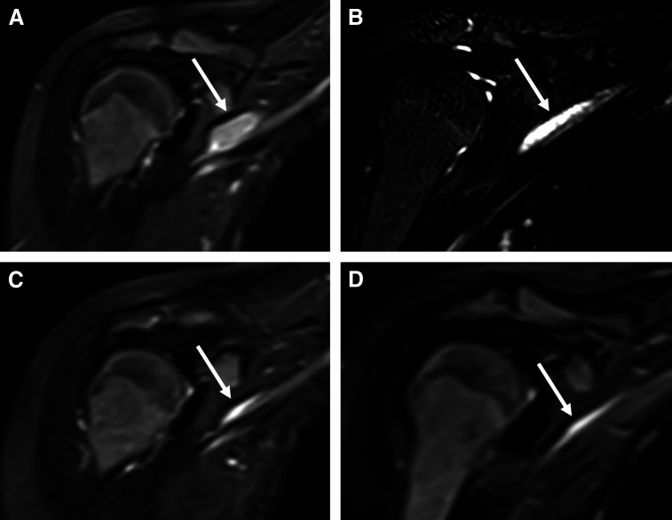 Fig 3.