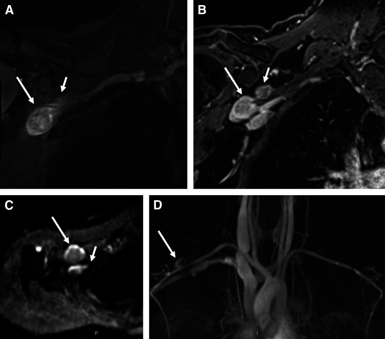 Fig 1.