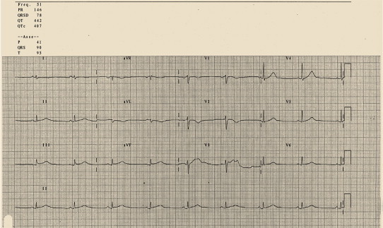 Fig. 12