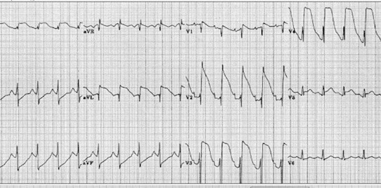 Fig. 13