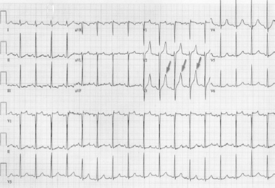 Fig. 11