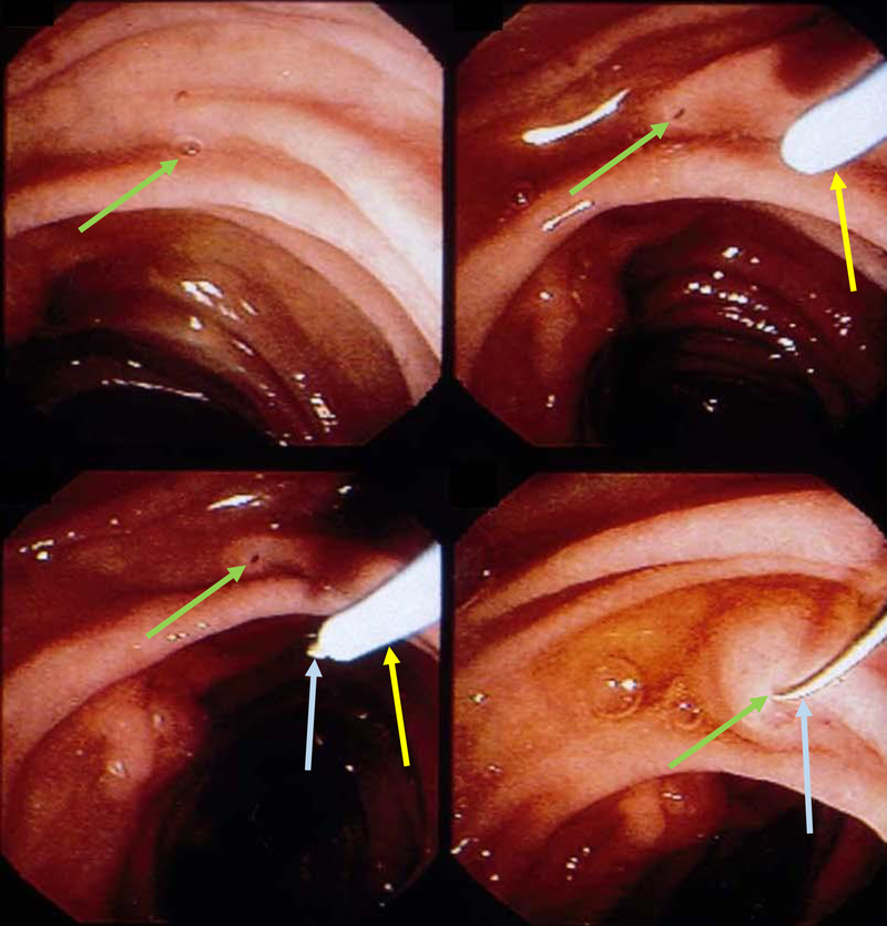 Figure 11: