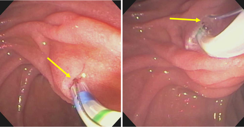 Figure 14: