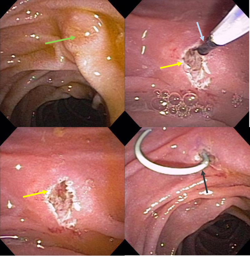 Figure 15: