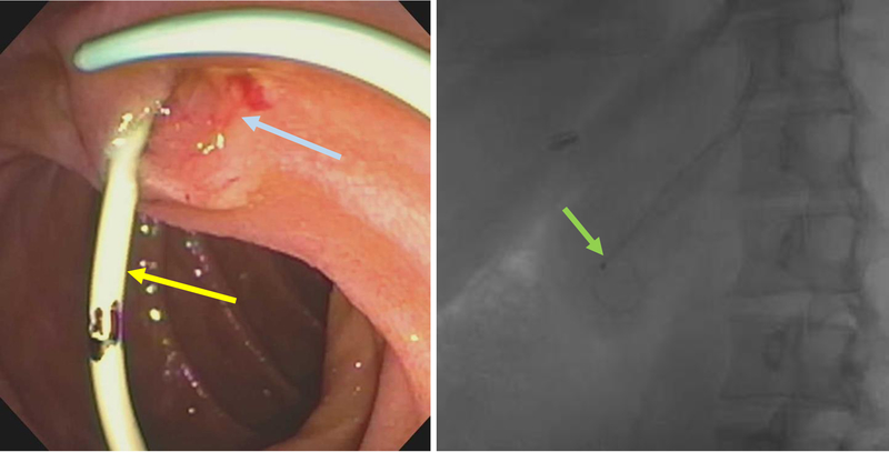 Figure 16: