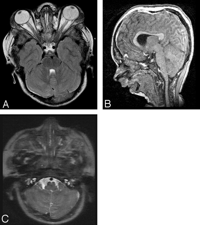 Fig 3.