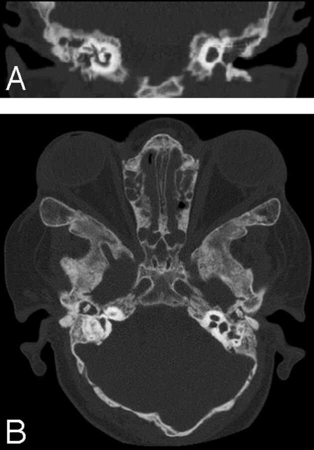 Fig 2.