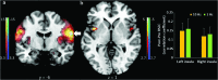 <b>FIG. 1.</b>