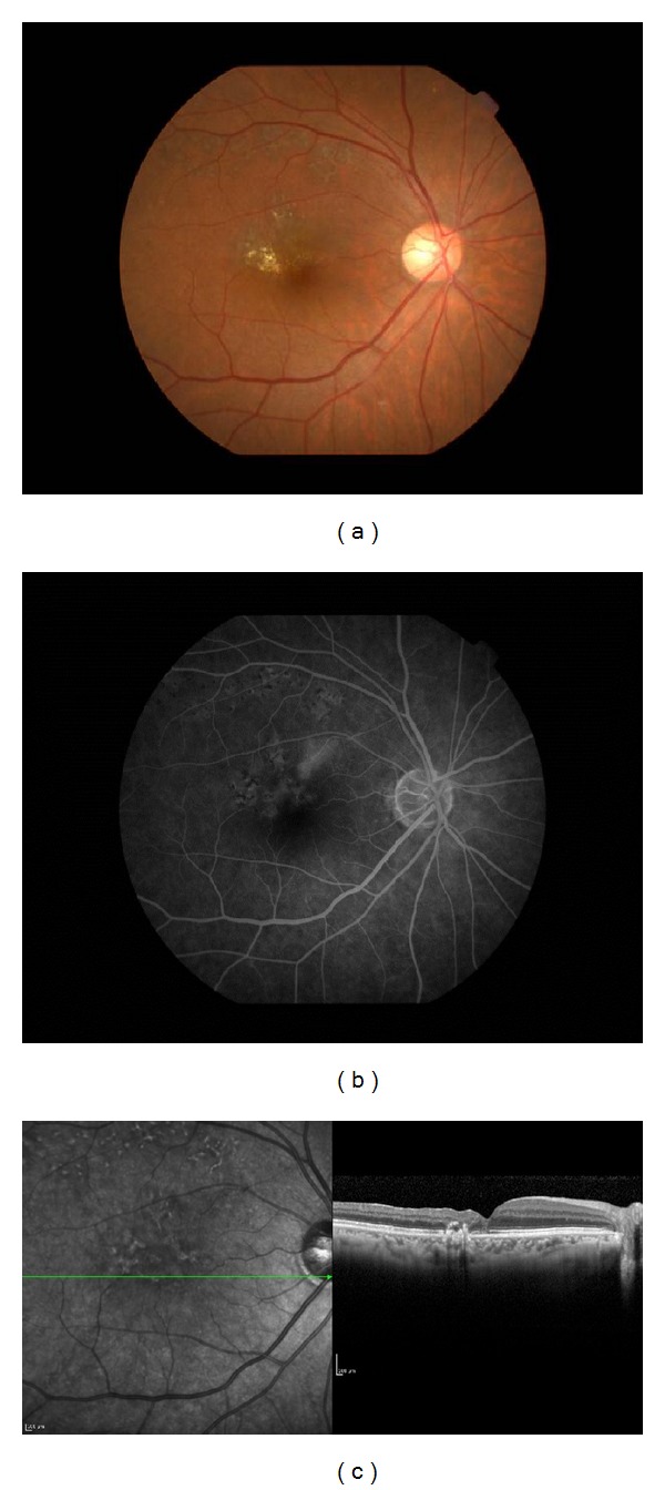 Figure 2