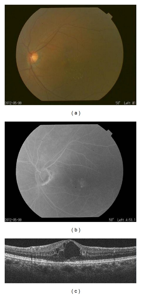 Figure 4