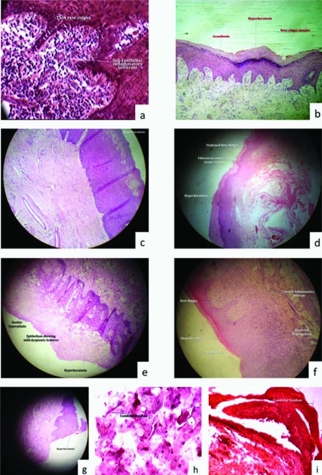 [Table/Fig-2a-i]: