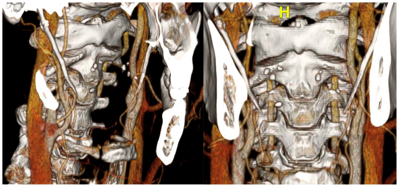 Fig 3