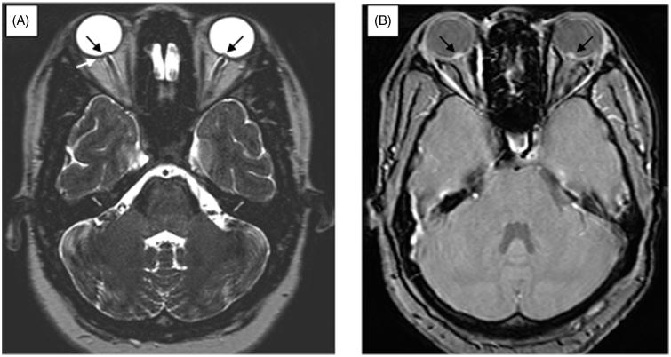 FIGURE 2