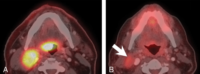 Fig 2.
