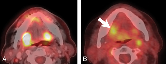 Fig 1.
