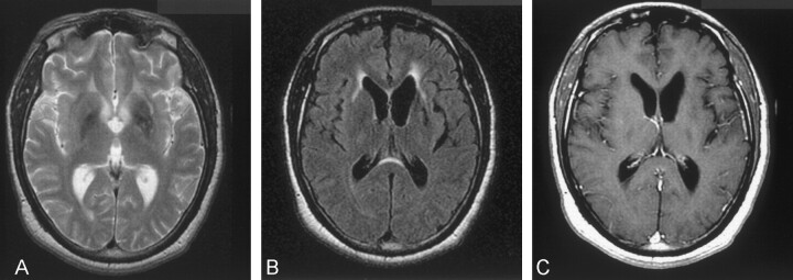 Fig 2.