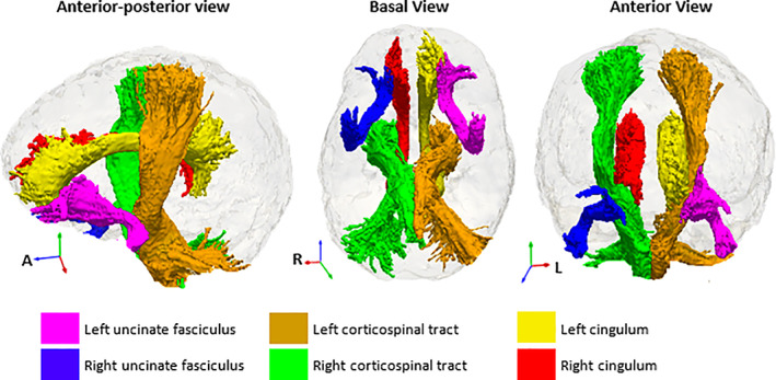 FIGURE 3