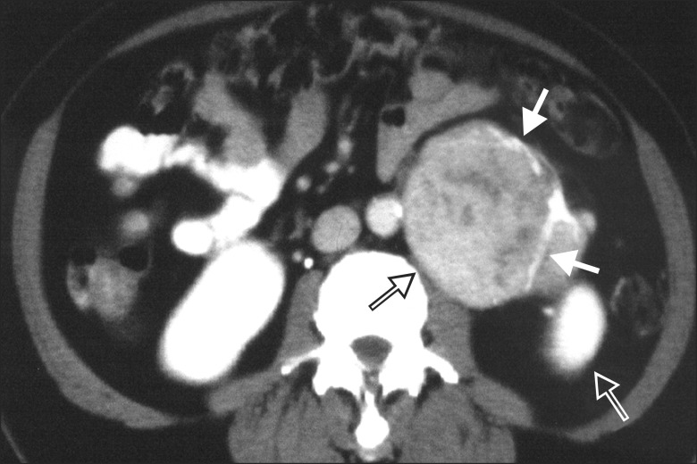 Fig. 13