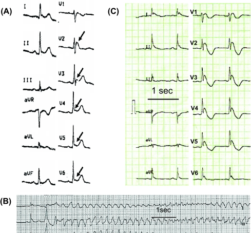 Fig. 1