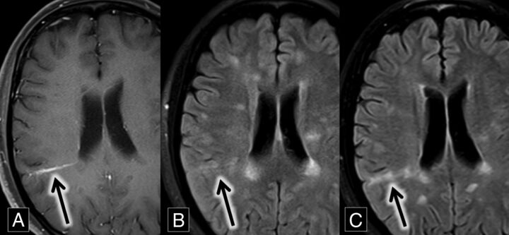 Fig 5.