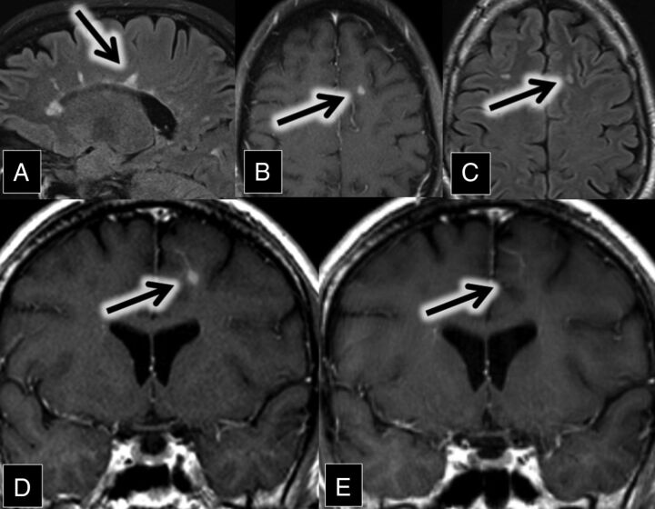 Fig 4.