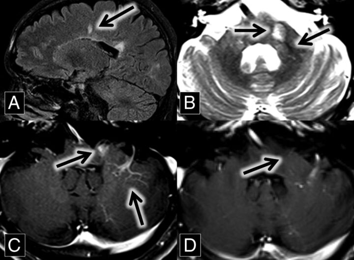 Fig 3.