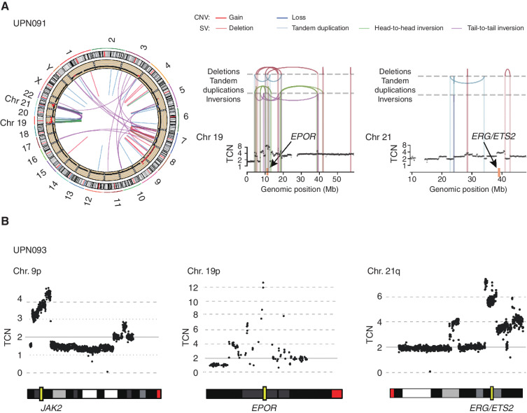 Figure 1. Gain/amplification affecting chromosomes 9p, 19p, and 21q in AEL. A, Complex SVs affecting chromosomes 19 and 21 for a representative case (UPN091). Left, CNVs and SVs are shown along chromosome ideograms. Chromosomes 19 (Chr 19) and 21 (Chr 21) are highlighted. Chromothripsis lesions involving chromosomes 19 and 21 are shown on the right. Yellow rectangles indicate the loci of EPOR and ERG/ETS2. B, An example of CNV (UPN093). The top and bottom panels show typical CN amplifications in chromosomes 9p, 19p, and 21q identified by WGS and the ideogram of the corresponding chromosomes.