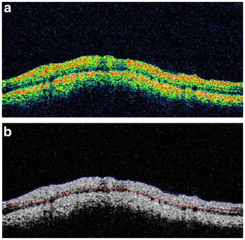 Figure 11 