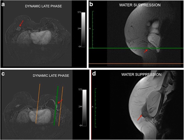 Fig. 9