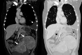 Fig. 11