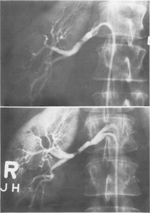 Fig. 12A&B.