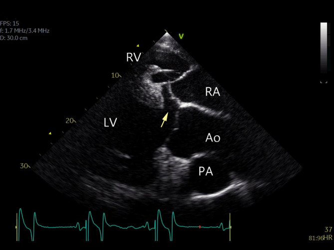 FIGURE 3