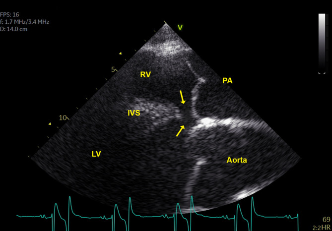 FIGURE 5