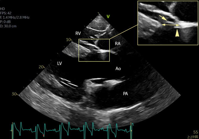 FIGURE 1