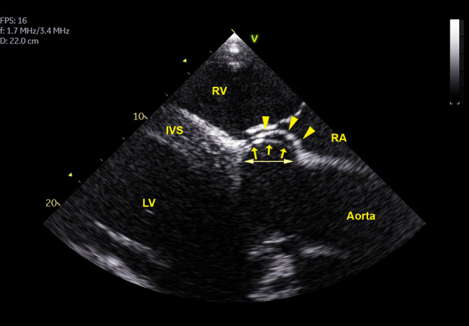 FIGURE 4