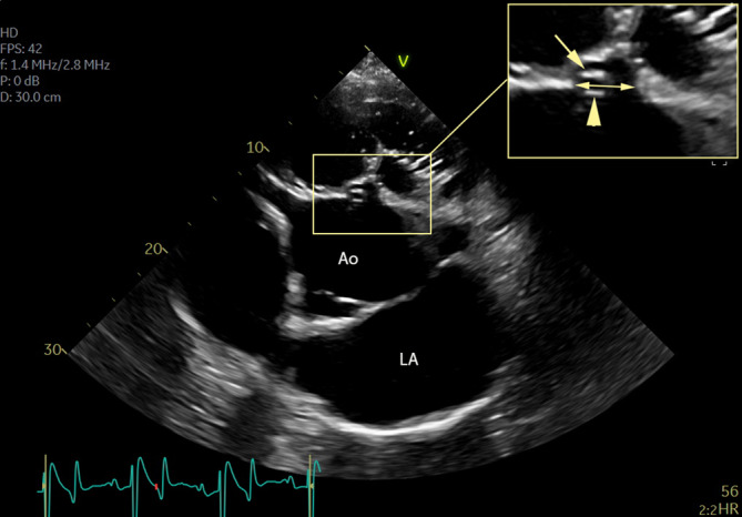 FIGURE 2