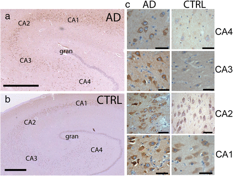 Fig. 11