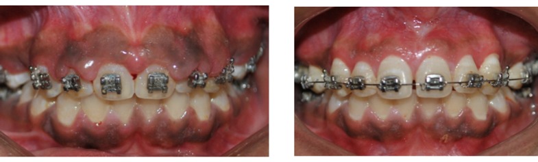 Fig. 3: Case 3 Pre and Post Operative Views