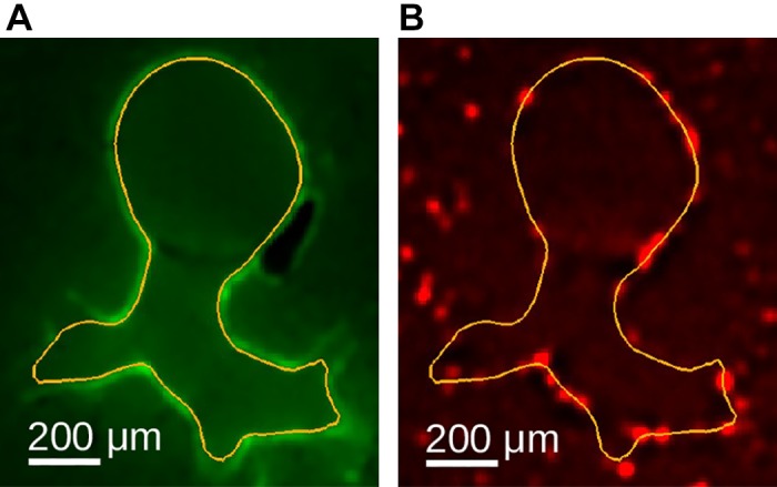 Fig. 15.